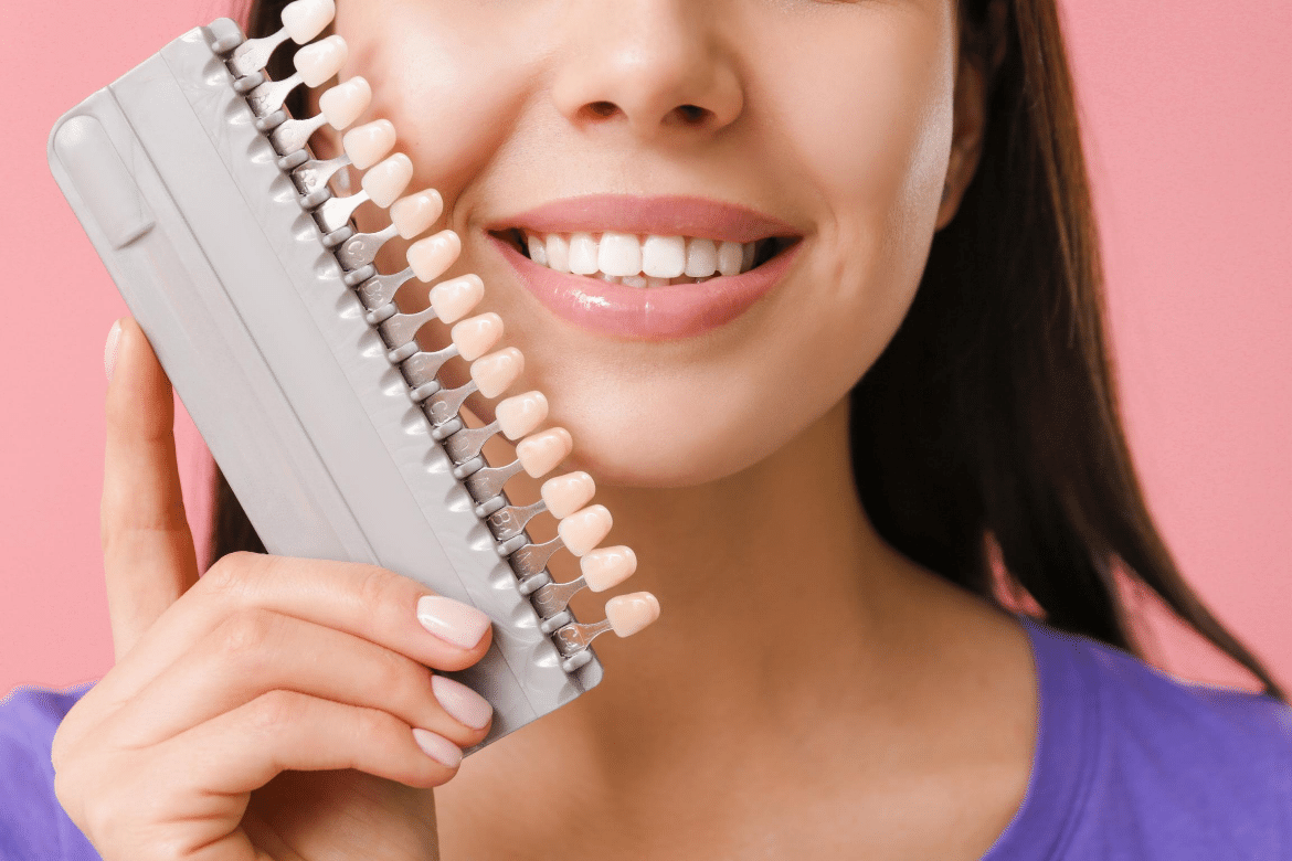 Guelph Dentist Porcelain Veneers