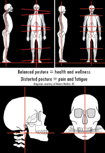 Posture Correction through Dentistry