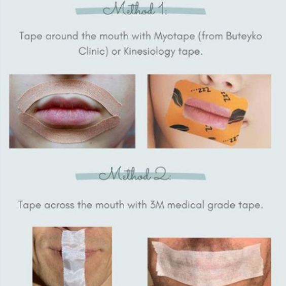 3M Micropore Tape for Sleep Mouth Taping - Quantified Bob