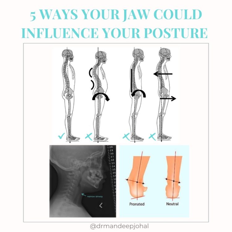 5 Ways Your Jaw Could Influence Your Posture - Family Dental Centre