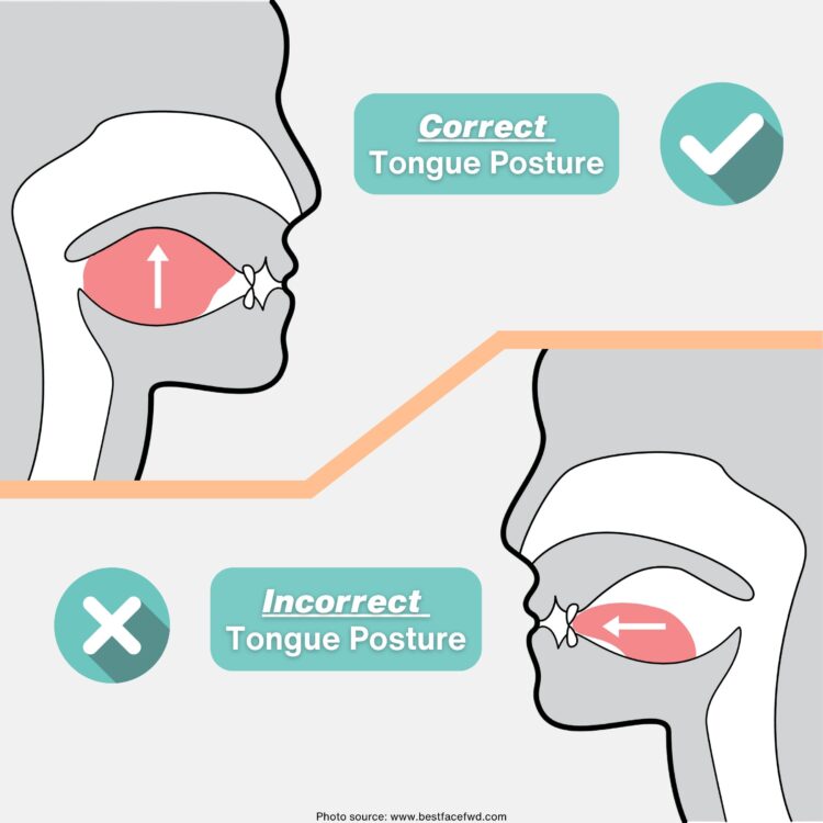 Concussions, TMD and Airway Dentistry: A Whole Body Approach to Healing ...