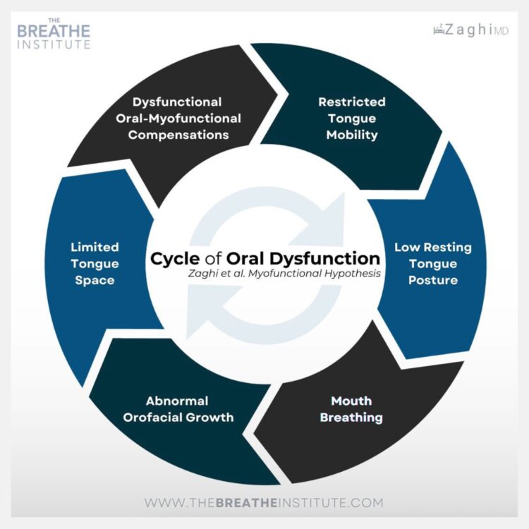 Cycle of Oral Dysfunction Diagram