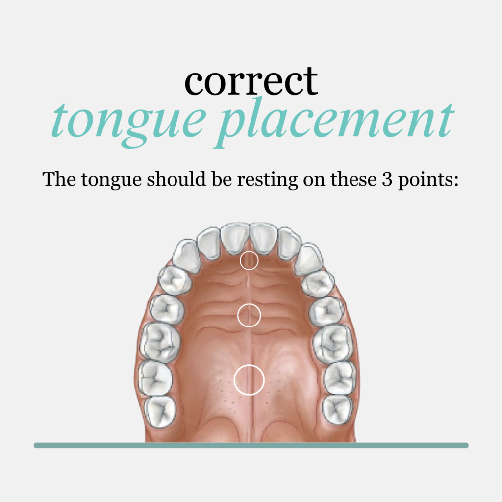 What Is the Correct Tongue Placement