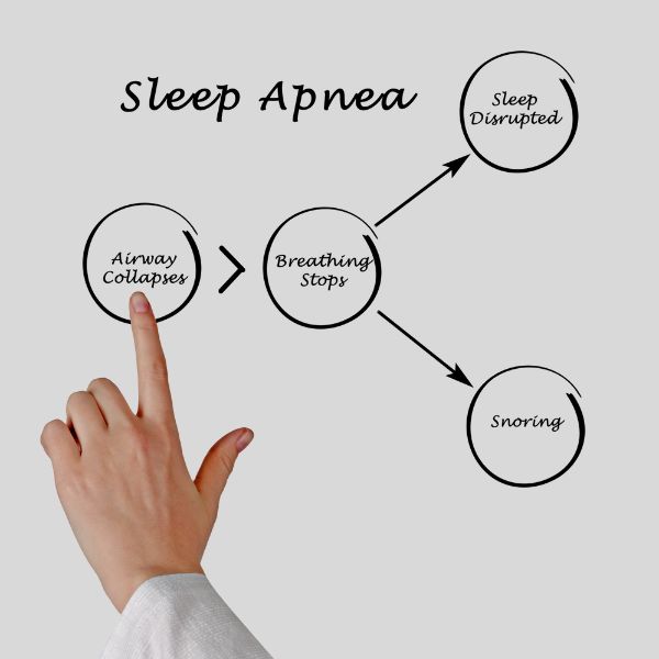 Stress Anxiety Sleep Issues Sleep Apnea